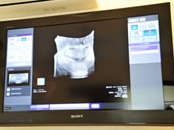 診療室内のモニタ 40インチのテレビモニタ