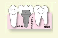 骨に穴を開けます